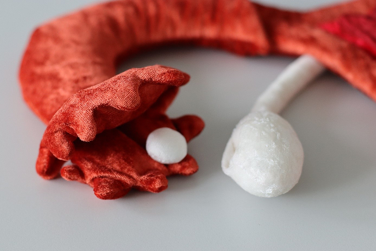 Ein Zyklusmodell aus Gebärmutter, Eileiter und Eierstöcken der Marke Paomi liegt auf einem Tisch. Zu sehen ist ein Eierstock und ein Eileiter kurz nach dem Eisprung.